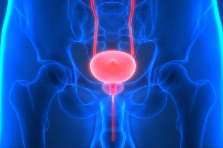 Октриха молекула, която помага за борбата с рака на простатата